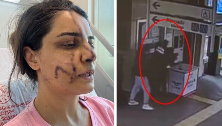 Marmaray İstasyonu’nda saldırıya uğrayan kadın, yüzündeki 40 dikişle dehşet dolu anları anlattı: Telefonla arayıp haber vermiş!
