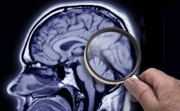 Demans ve Alzheimer: Belirtileri nedir, hangi tedaviler uygulanıyor?