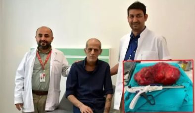 Ağrıyla gitti, 8 kiloluk tümör çıkarıldı!