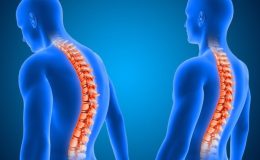 Duruş bozukluğunu önlemek için 8 basit ipucu