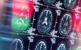 AB, ‘tarihi’ Alzheimer ilacına ruhsat vermedi: ‘Faydası, riskleri görmezden gelecek kadar değil’