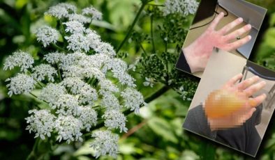 Dünyanın en tehlikeli bitkisi… Türkiye’de nerelerde var?